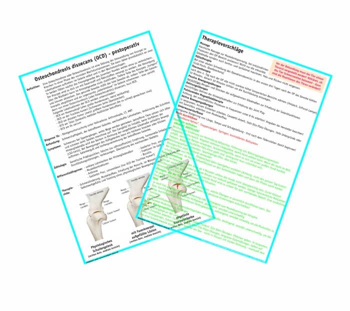 Osteochondrosis dissecans